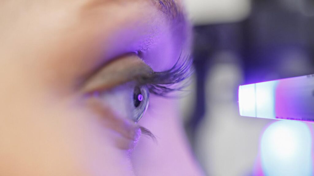 Use this effective 8-step guide to prepare for your cataracts surgery