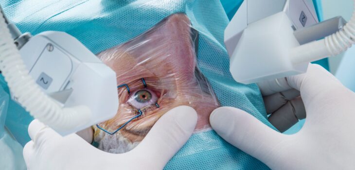 Types of cataracts surgery