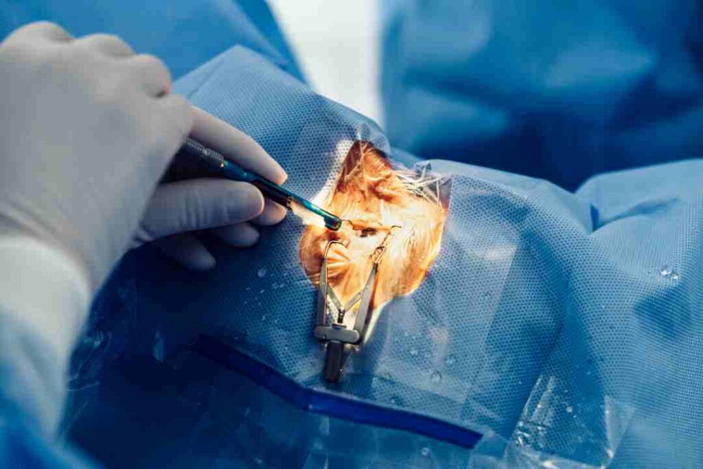 Age-Related Cataracts: Causes, Symptoms, and Treatment Options